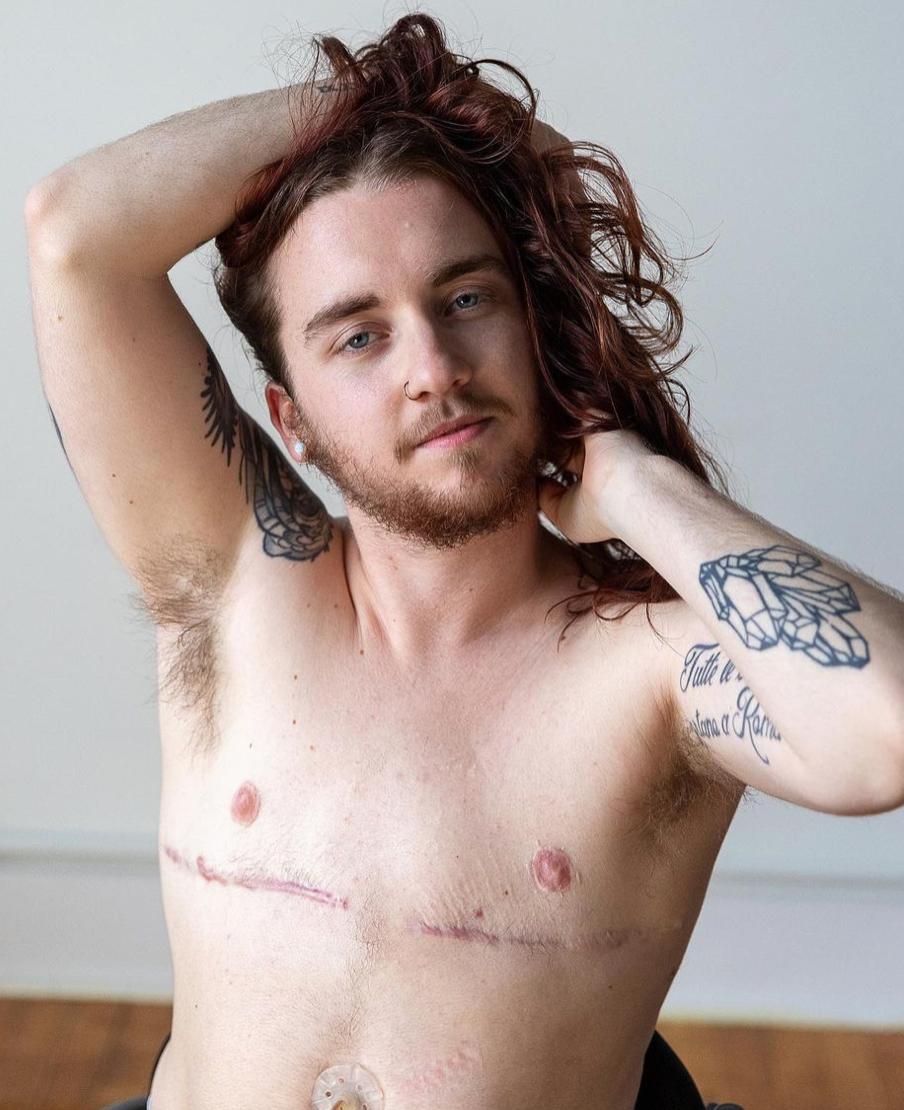 Julian Gavino The Disabled Hippie Disabled with Dignity Zebedee Models We Speak Model Management representation disability transgender trans influencer coach
